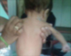 Bebê de 5 meses é internado, após ter ingerido drogas dadas pela mãe no Pará