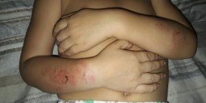 Parauapebas: Criança de 3 anos é agredida em creche