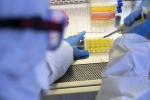 Anvisa aprova teste de anticorpos do novo coronavírus