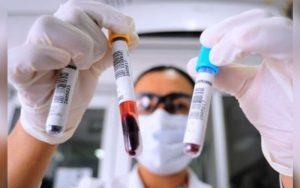 Tipo de sangue pode influenciar evolução e recuperação da Covid-19, diz estudo