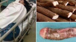 Mulher vai parar no hospital após se masturbar com macaxeira