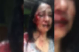 Moradora de Palmital diz que foi agredida por nove vizinhos por acharem que ela havia denunciado som alto à polícia