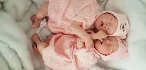 Parto raro: gêmeas empelicadas nascem no mesmo minuto em hospital de MG