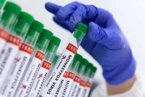 RJ confirma primeira morte por varíola dos macacos no estado