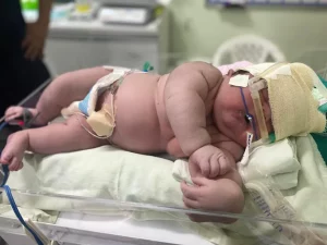 ‘Bebê Gigante’ nasce com mais de 7 kg em maternidade de Parintins, no interior do AM